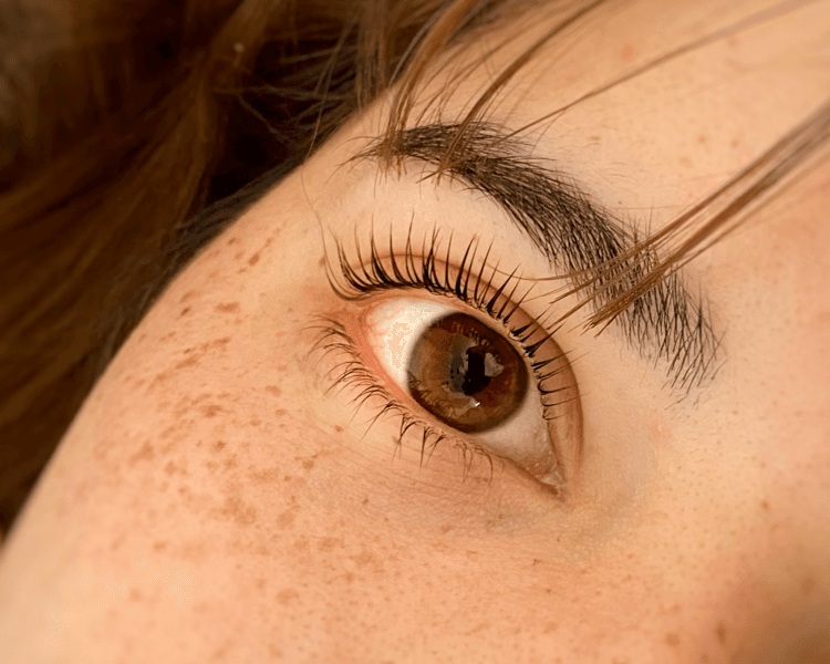 COMBO 1 (lifting completo+perfilado)