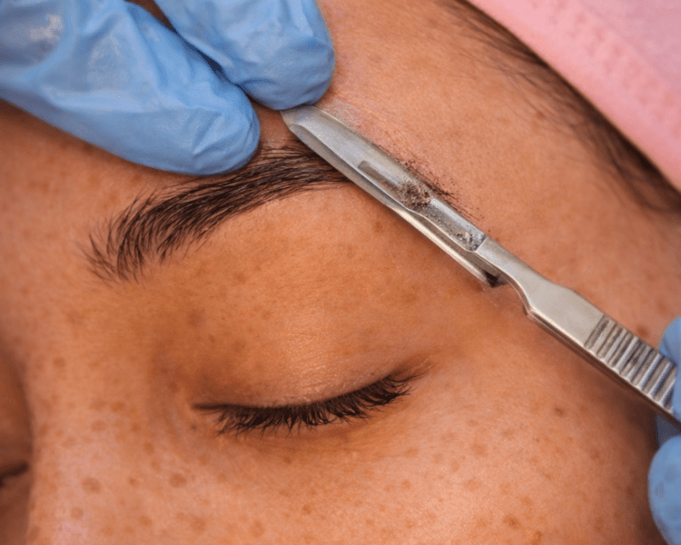 Dermaplaning Facial