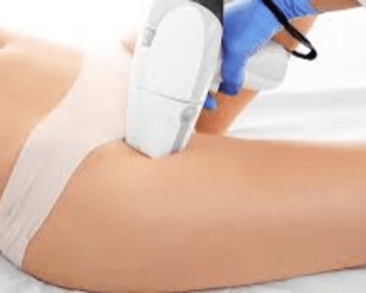 Silk Body Experience (Piernas Completas+Axilas+Cavado Bikini) x 4 sesiones-Precio Unitario $59000