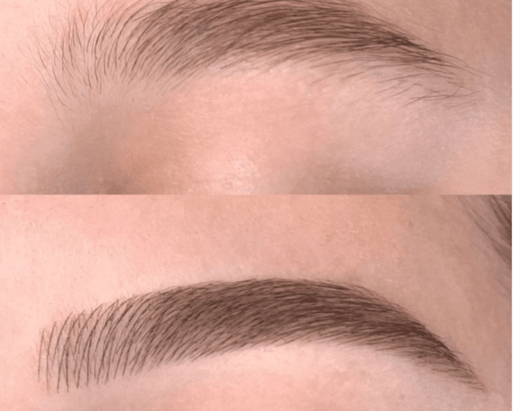 Técnica Hibrida 🌟