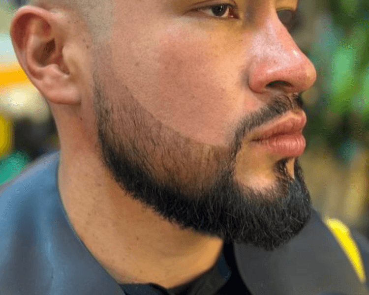 PIGMENTACION DE BARBA