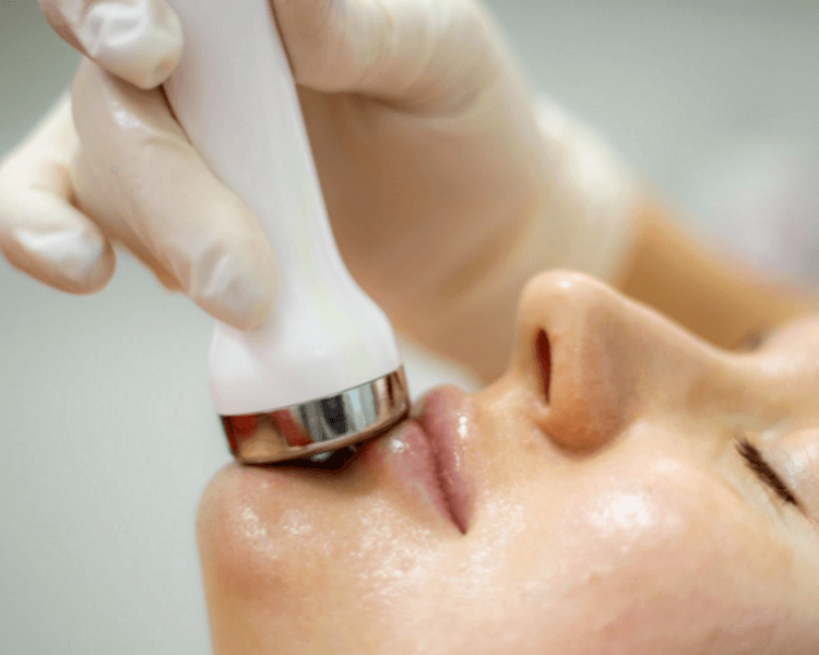 1 sesión de Radiofrecuencia facial (incluye cuello y escote) - TRANSTEC