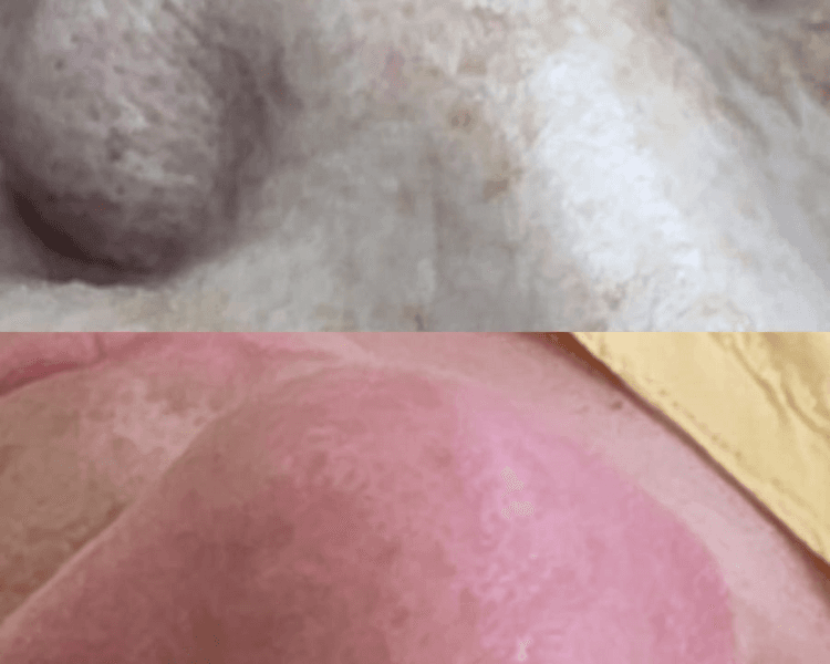 Limpieza facial profunda