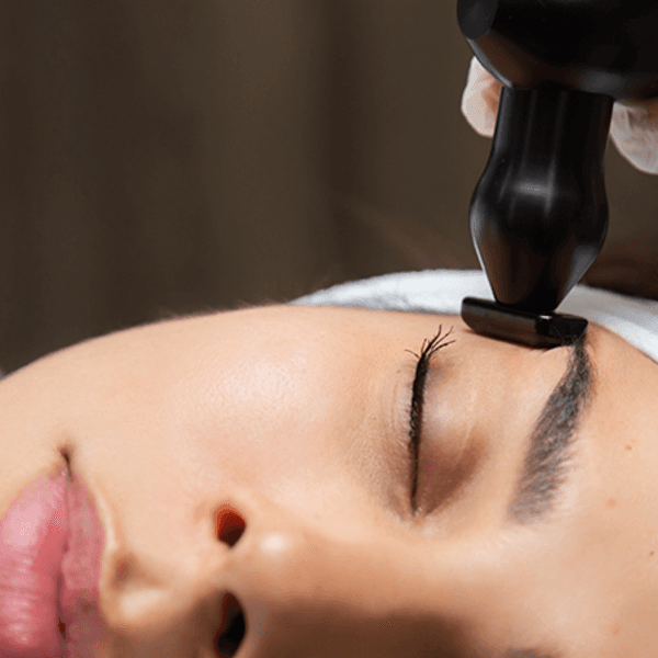 REJUVENECIMIENTO FACIAL