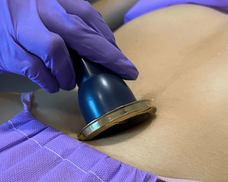 Post-Op Crystal Recovery