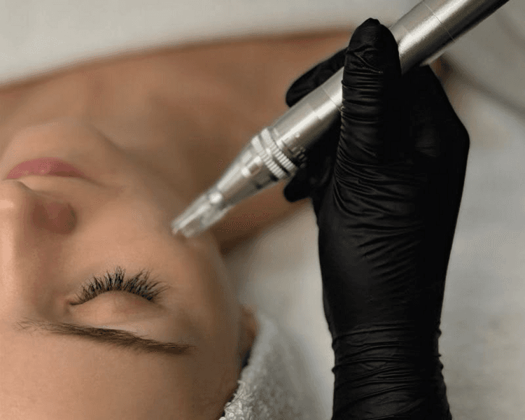 Dermapen + Coctel personalizado