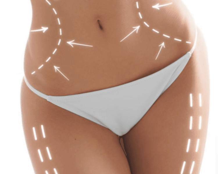 Vela slim + Mio Up (2 zonas vela +2 zonas Mio)