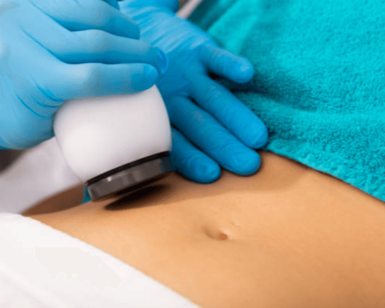 Electroporador por zona