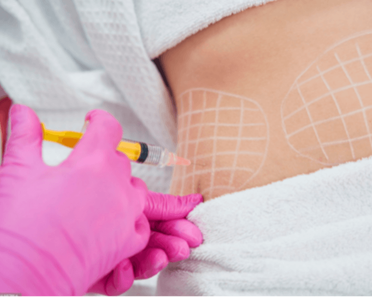 Mesoterapia por zona