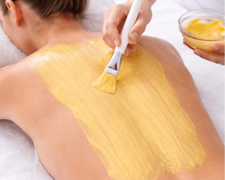 Peeling Químico Yellow x zona