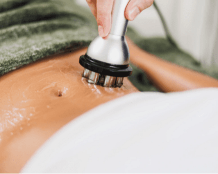 Radiofrecuencia por zona