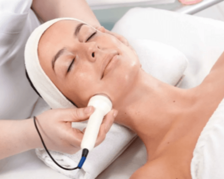 Radiofrecuencia Exprés