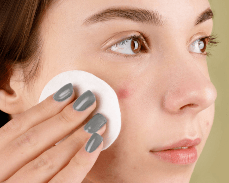 Tratamiento para acné