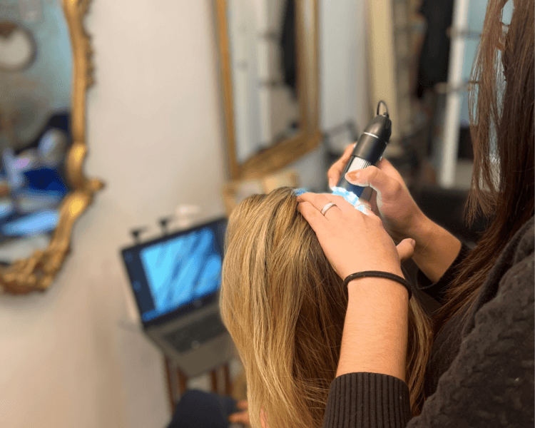 SCALP RENEW THERAPHY