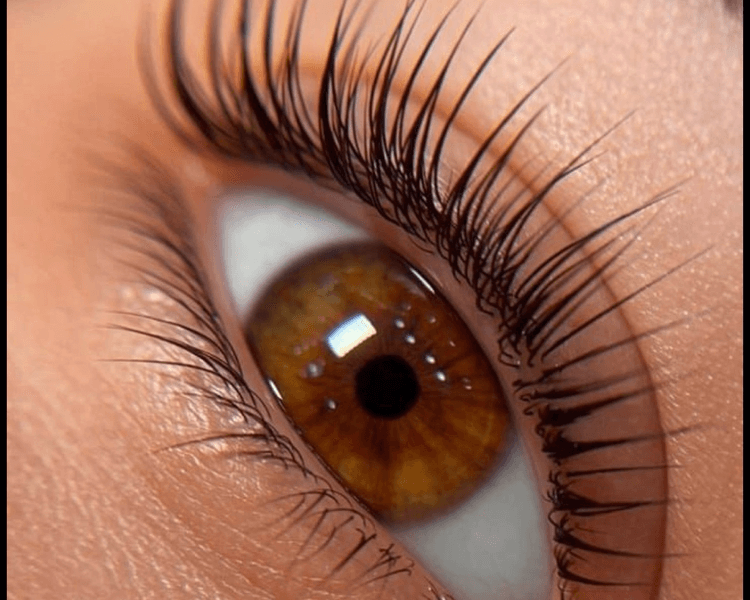 Lifting y botox, sin tinte