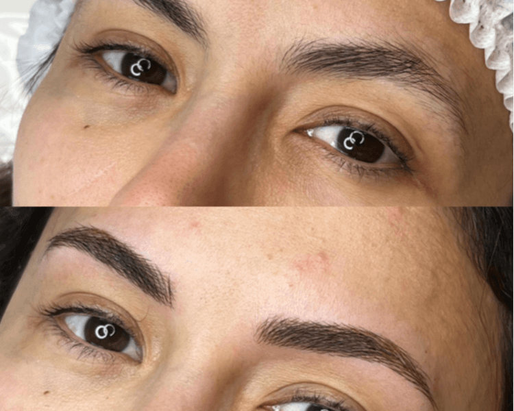 Microblading