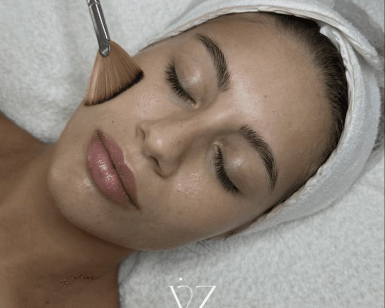 LIMPIEZA FACIAL + TRATAMIENTO DELUXE (DERMAPLANING, MICRONEEDLING O PEELING -SOLO UNO-)