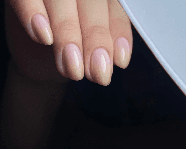 Kapping con nivelación simple