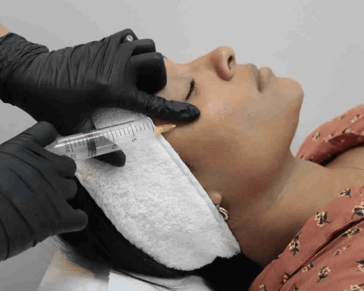 Ozonoterapia en rostro