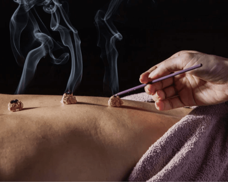 Moxibustión o moxas