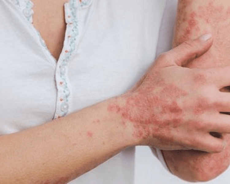 CONSULTA DERMATOLOGIA GENERAL - OSDE/ Swiss Medical