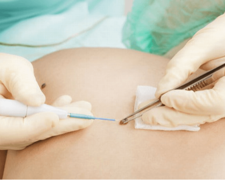 PRACTICA DERMATOLOGIA - PARTICULAR