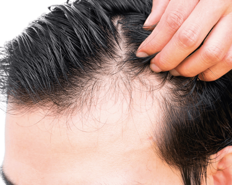 CONSULTA CAPILAR - PARTICULAR