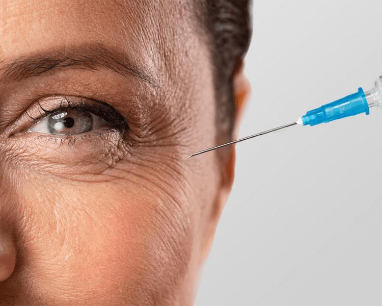 Toxina botulinica (Xeomin), aplicación en tercio superior de la cara - PARTICULAR