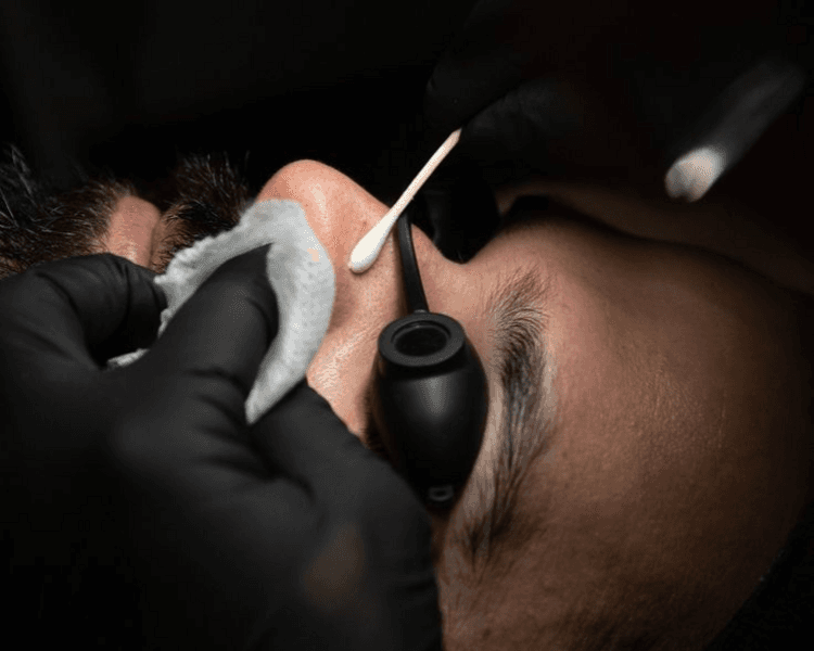 FACIAL ESENCIAL EXTRACCION