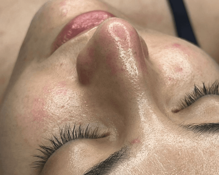 Si es tu primera vez la sesión que más te recomiendo para comenzar es la Limpieza Facial Dermaclean Pro.