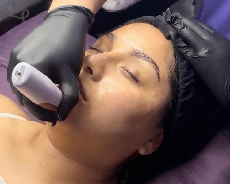 Limpieza Facial + dermaplaning + Dermapen EpiGlow