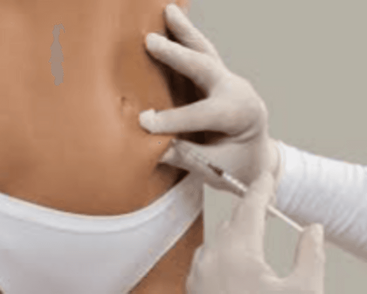 MESOTERAPIA CORPORAL