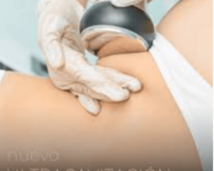 ULTRACAVITACION