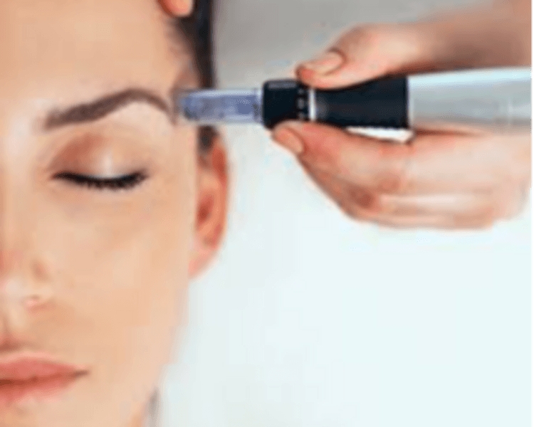 DERMAPEN+PLASMA RICO EN PLAQUETAS O MESOTERAPIA + ALTA FRECUENCIA en rostro cuello escote