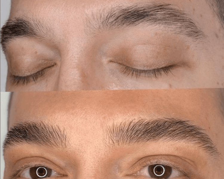 Pigmentacion de cejas