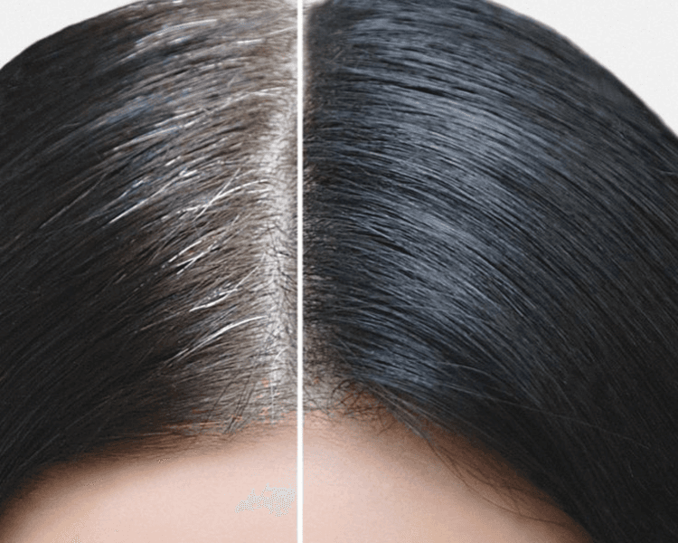 Cobertura de raiz - Women