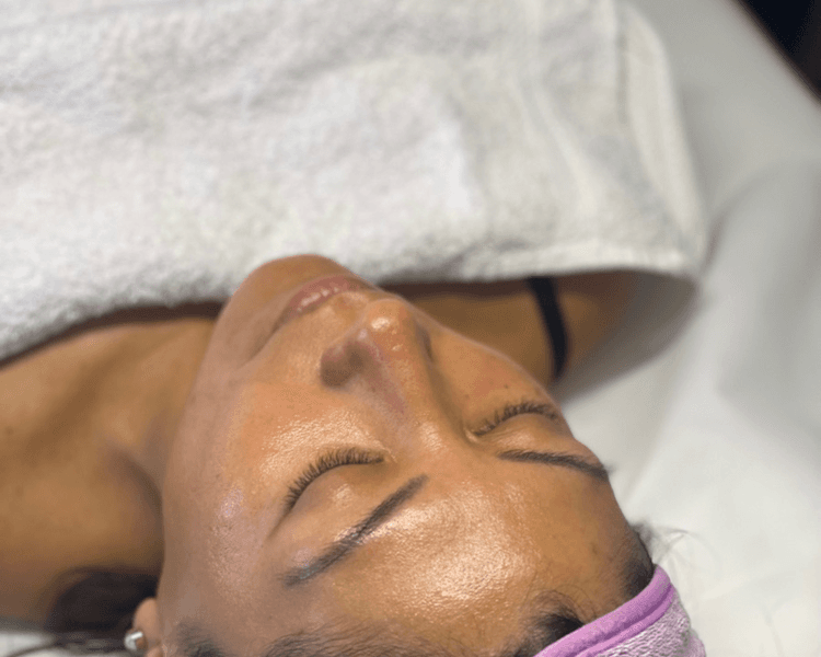 LIMPIEZA PROFUNDA + DERMAPLANING