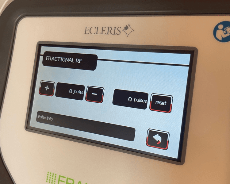 FRAXFACE radiofrecuencia fraccionada rejuvenecesora