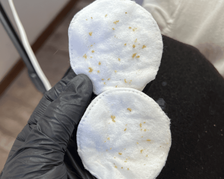 Limpieza facial profunda