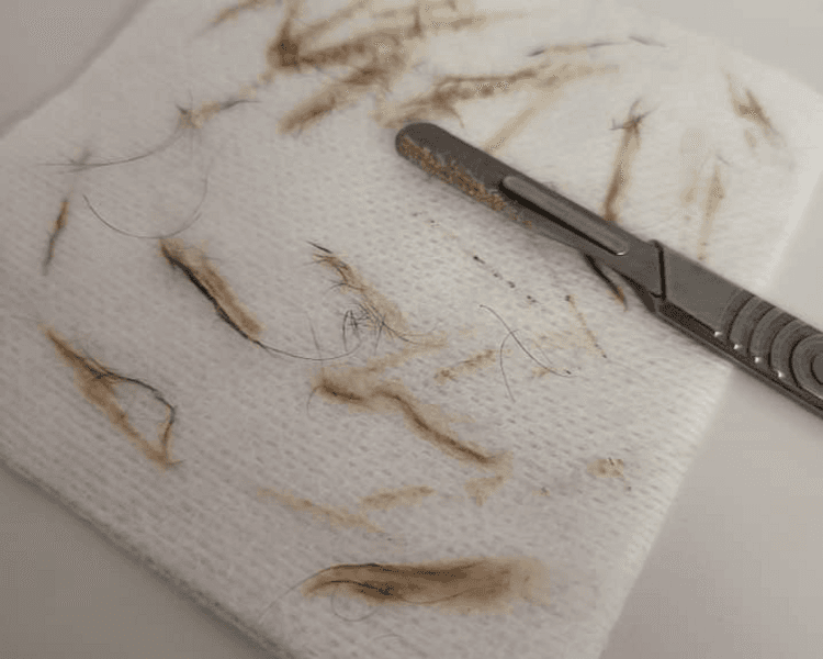 Limpieza facial profunda + Dermaplaning