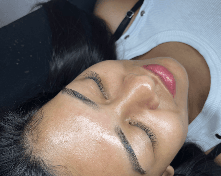 Limpieza facial profunda + Dermapen (microneedling)