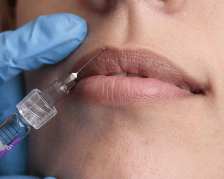 Hidratación de labios con hialurónico