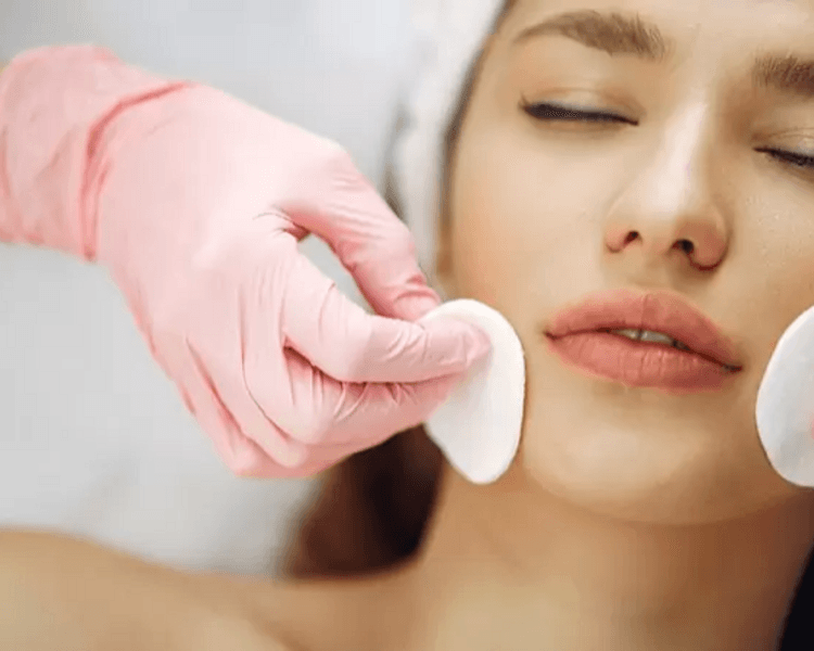 Limpieza Facial Premium con Peeling Químico
