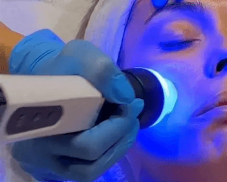 Hidratación y Revitalización Profunda · Bono de Mesoterapia