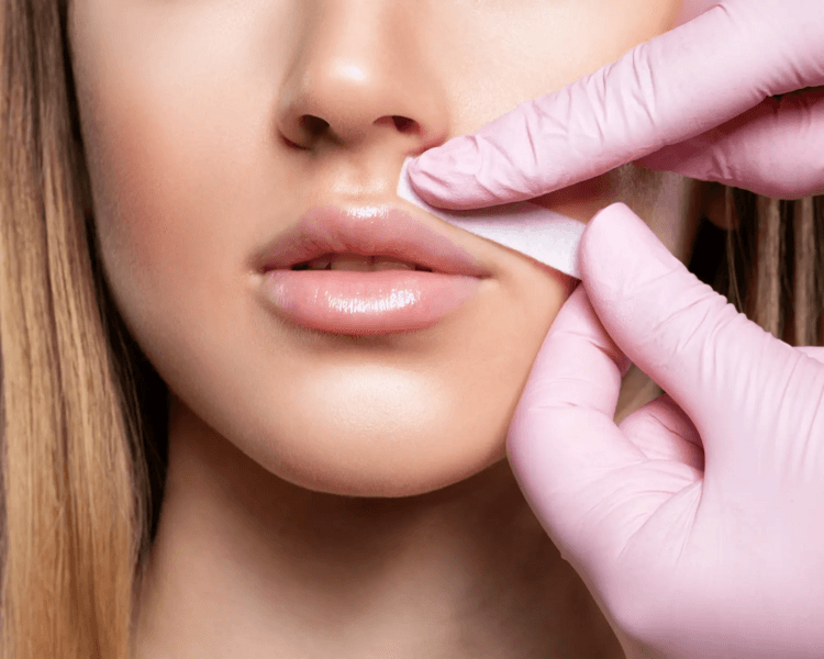 DEPILACION FACIAL COMPLETA