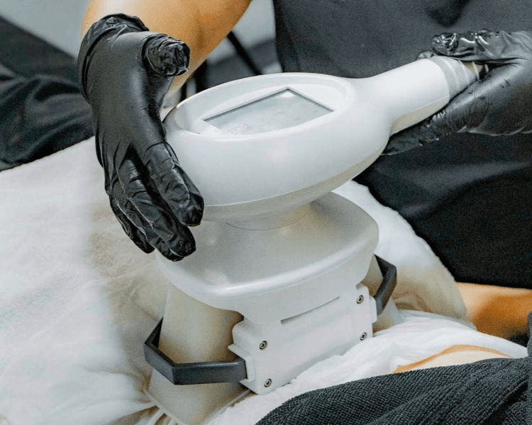 CRIOLIPOLISIS PROMOCIÓN