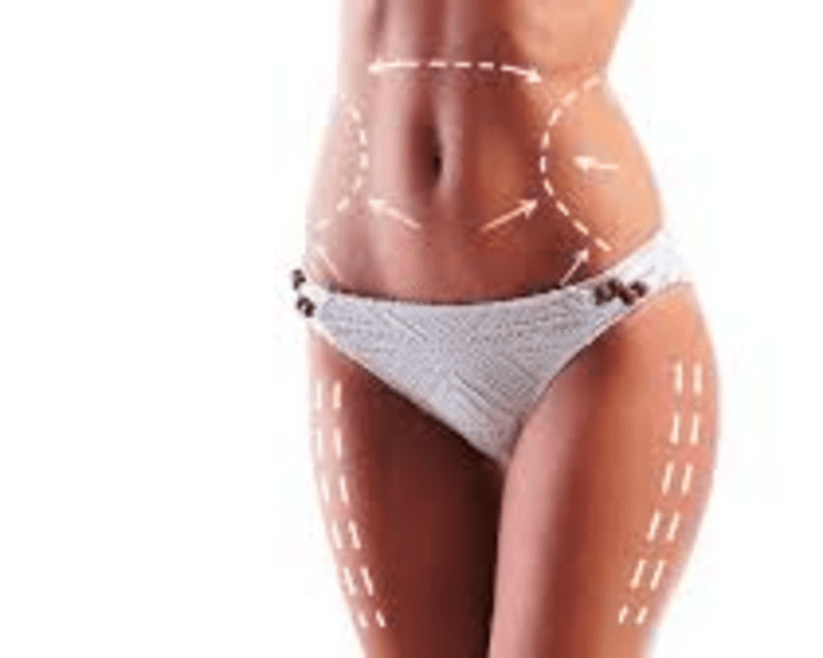 Reductivo Corporal Personalizado