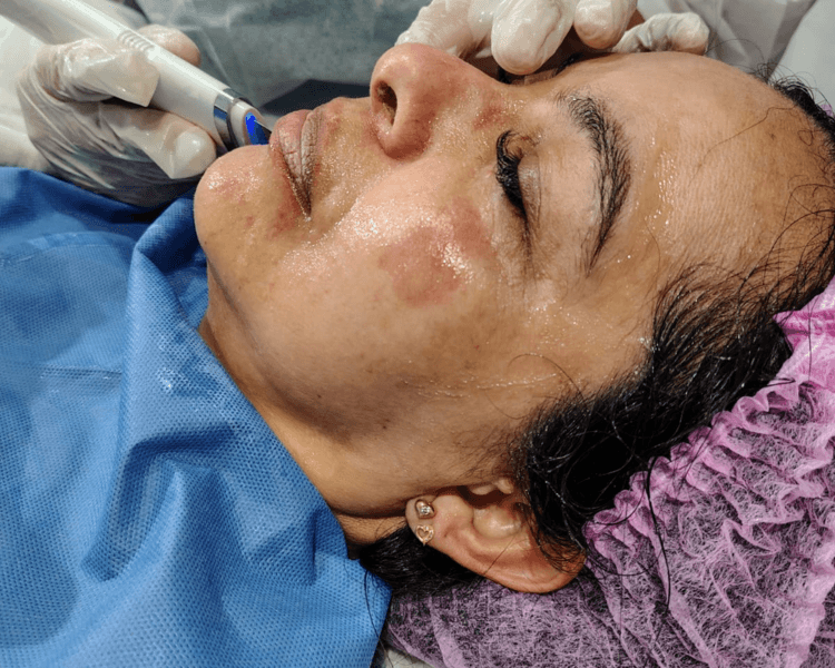 Estética Facial y Corporal.