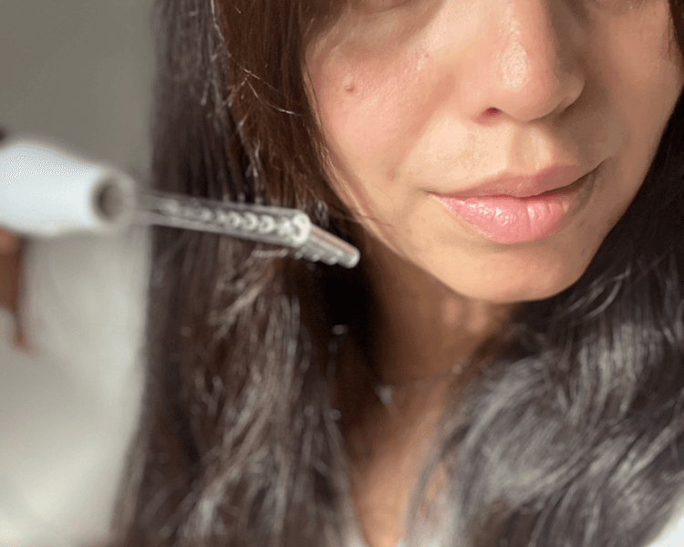 ALTA FRECUENCIA CAPILAR