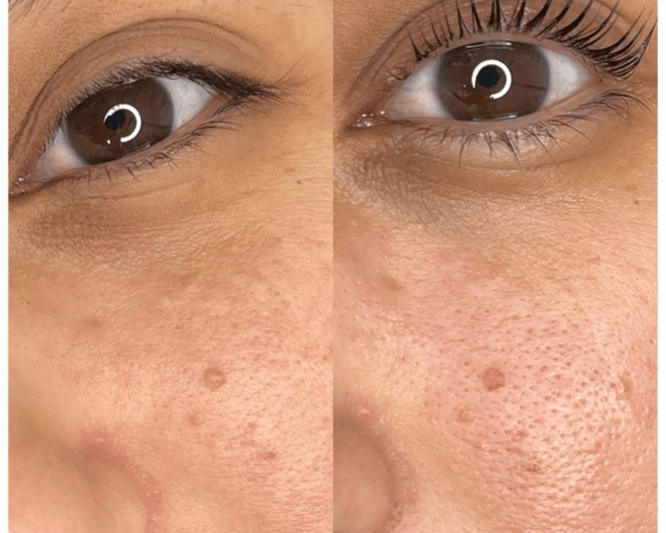 Lifting de pestañas con tinte